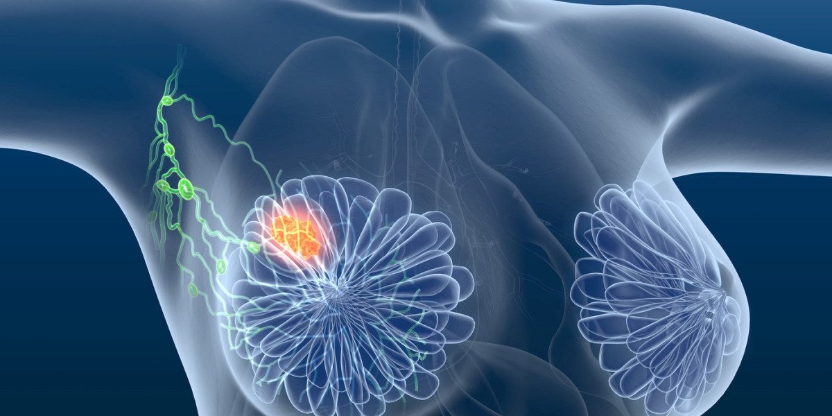 Der Einfluss von körperlichem Training auf das Immunsystem von Brustkrebspatienten