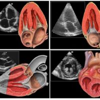 Herz ist nicht gleich Herz: Genetische Varianten verändern Herzstruktur