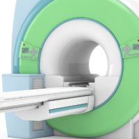 Schädel-Hirn-Traumen bei Kindern: auf CT und MRT verzichten
