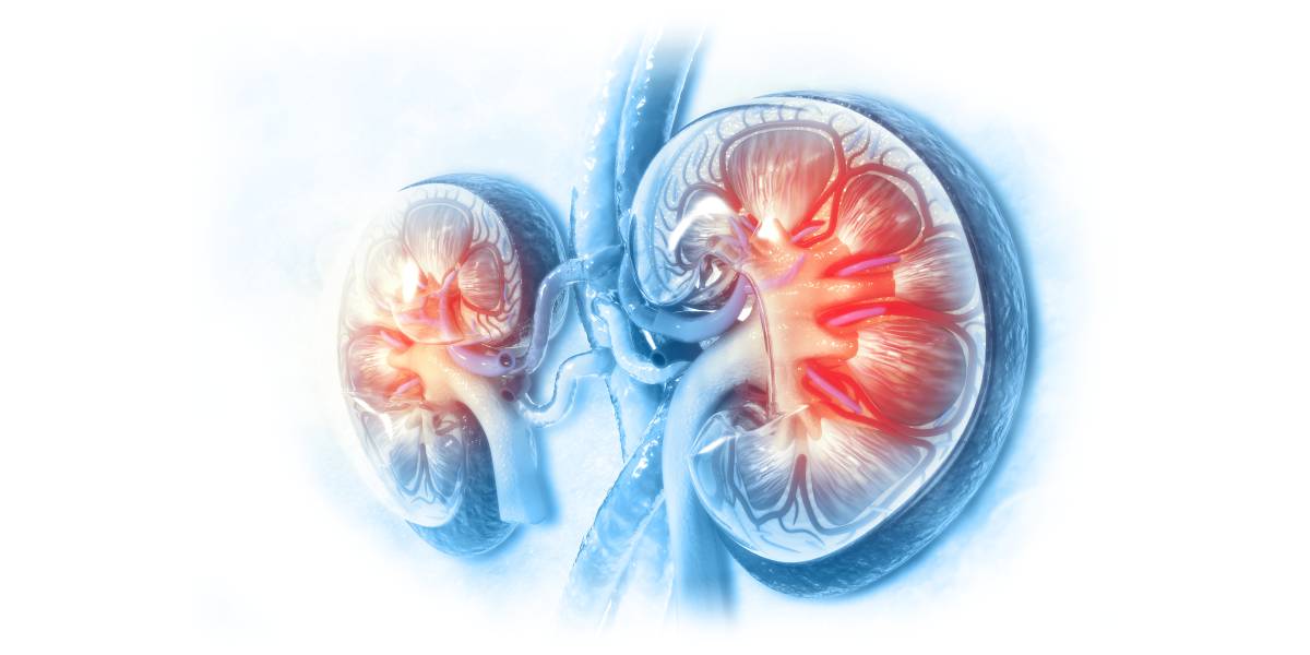 Nieren: Krafttraining während Dialyse vermindert inflammatorische Prozesse