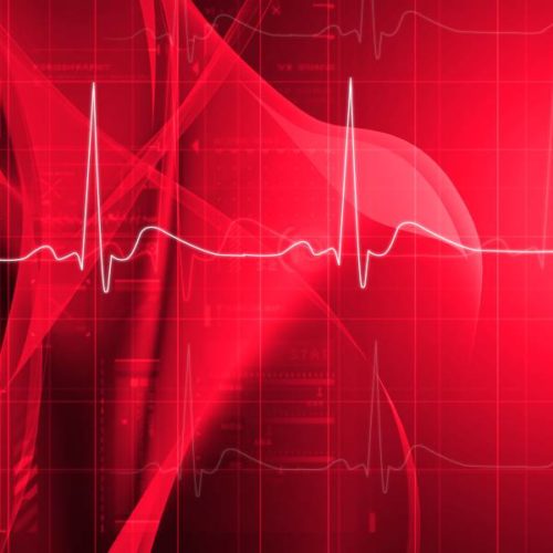 Risikobasiertes Herz-Screening auch bei jungen Athleten?