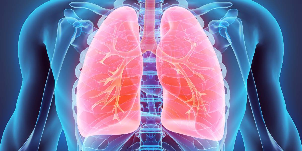 Veränderungen der Diffusionskapazität der Lunge nach SARS-CoV-2-Infektionen bei hochtrainierten Sportlern