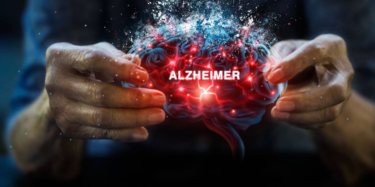 Irisin: Könnte das »Sporthormon« Alzheimer stoppen?